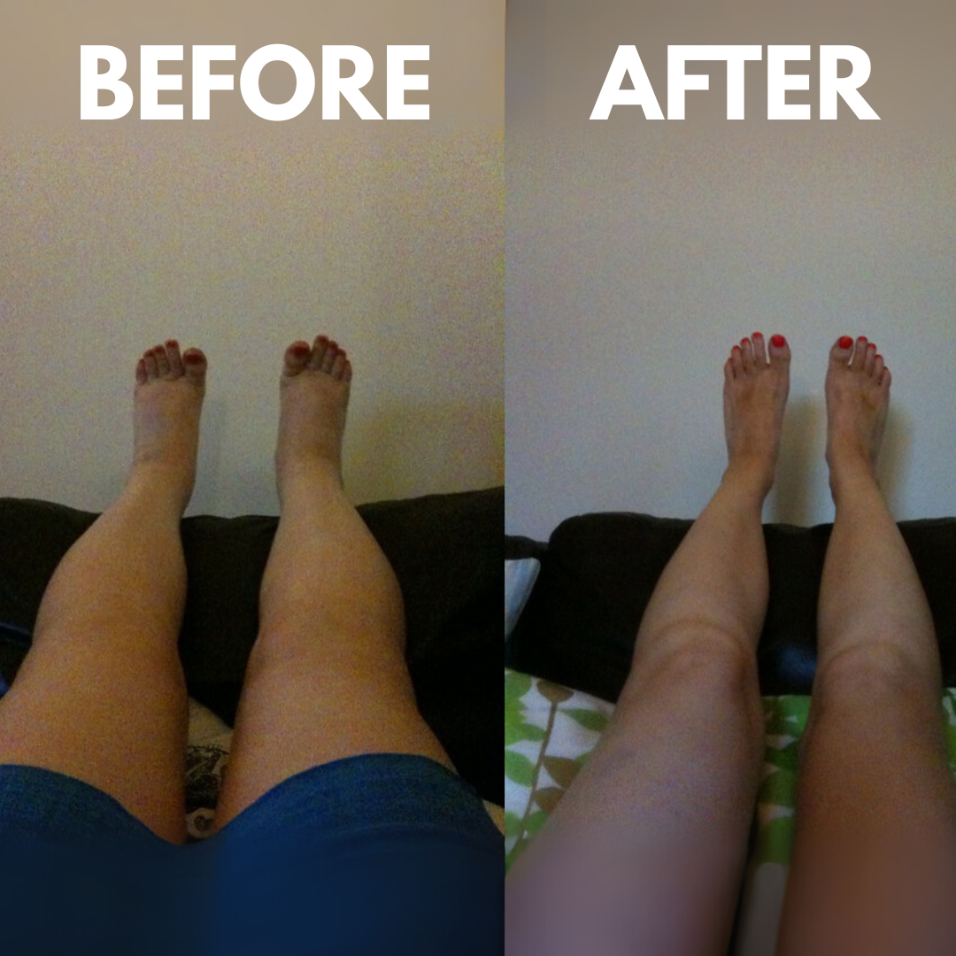 Cordless Heated Calf Massager